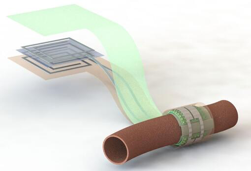 上圖描繪了這款可生物降解的壓力傳感器，它圍繞著一根血管，天線在左側(cè)(分離的層狀結(jié)構(gòu)，展示了天線結(jié)構(gòu)的細(xì)節(jié))